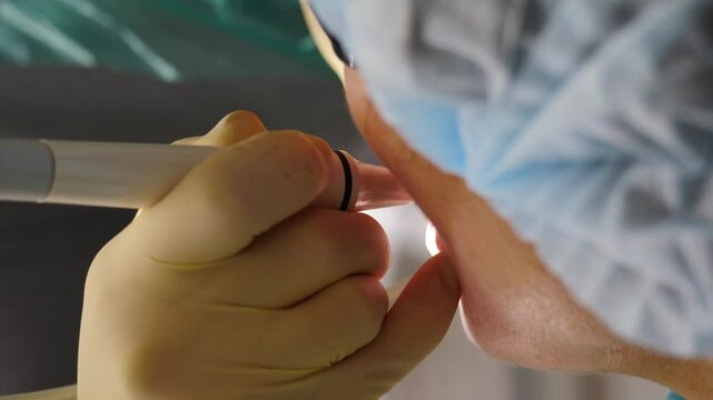 Dentist wearing gloves makes dental cleaning procedure using a dental ultrasound tool, Vertical footage. Professional clinic environment. Full hd