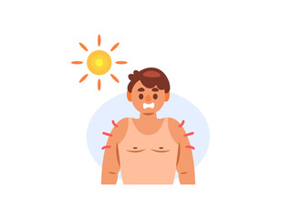 illustration of a man shocked because his skin color has become patchy. skin color darkens due to exposure to sunlight. sunburn. result or effect of sunbathing. flat style character design
