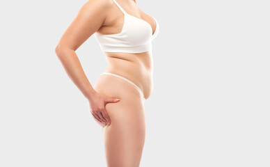 The girl stretches the skin on the leg and on the stomach, showing fat deposits. Treatment and getting rid of excess weight, the deposition of subcutaneous fat.