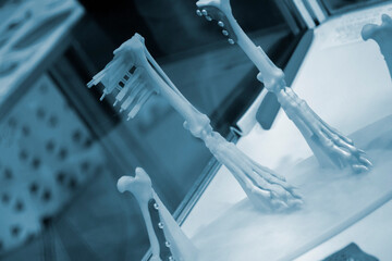 Implants and prostheses printed on 3D printer from biocompatible titanium powder. Plates for...