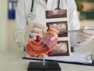 Doctor examines digestive system model and ultrasound image