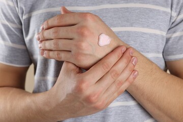 Man with moisturizing cream on hand, closeup