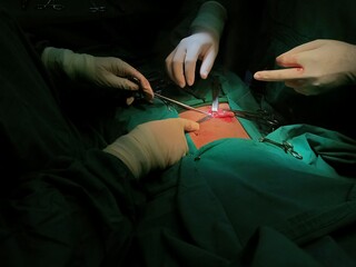 Appendix specimen from appendectomy, after surgery from the doctor.	
