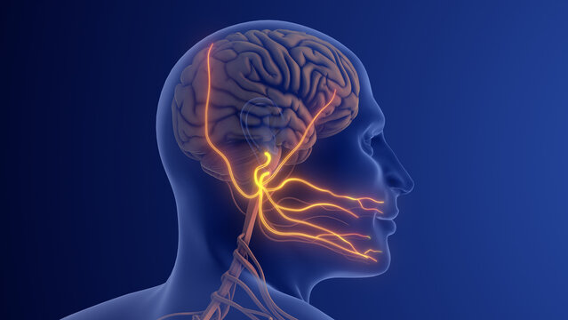 Trigeminal Neuralgia Causing Severe Facial Nerve Pain