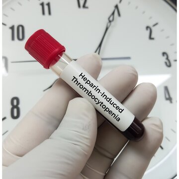 Blood sample for Heparin Induced Thrombocytopenia (HIT) PF4 Antibody, IgG with Reflex to Serotonin Release Assay (Heparin Dependent Platelet Antibody), Unfractionated Heparin.