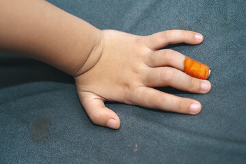 close up of toddler's hand wearing plaster on his finger