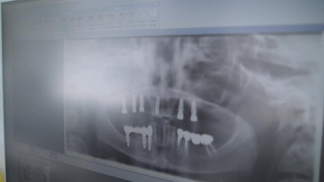 dentistry. orthodontics. human jaw image. panoramic dental image. 3d. modern medical technologies. fluorography jaw image and human teeth structure in the image
