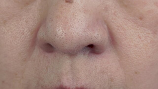 senior woman worry about enlarged pores skin and blackhead on face.