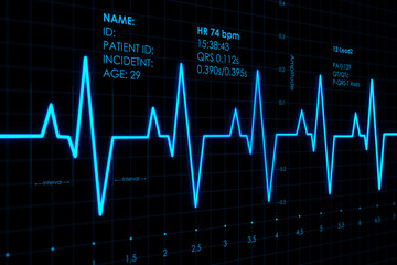 Cardiology concept with blue digital heart rate chart and personal patient information on dark...