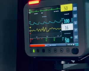 Close-Up of a Patient Monitoring System Displaying Vital Signs in a Hospital ICU