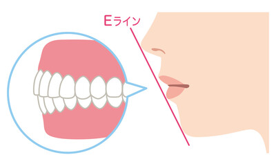 キレイな歯並び　理想的なEライン　歯列矯正 © koti