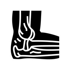 dislocated joint fracture glyph icon vector. dislocated joint fracture sign. isolated symbol illustration