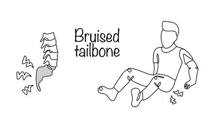 Bruised tailbone