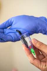 Hirudotherapy procedure. Doctor applying leech to patient's body. Close-up of doctors hand with leech. Hirudotherapy, Ethnoscience and Alternative medicine. Selective focus.