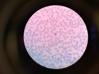 Plasmodium vivax is a protozoal parasite and a human pathogen. This parasite is the most frequent and widely distributed cause of recurring malaria.