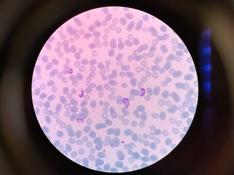 Plasmodium vivax is a protozoal parasite and a human pathogen. 