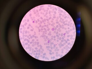 Plasmodium vivax is a protozoal parasite and a human pathogen. 