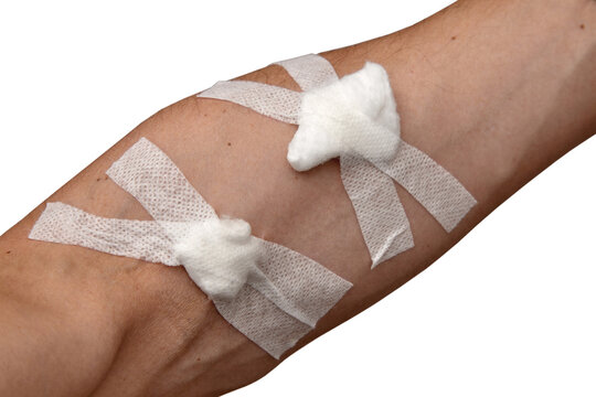 Human arm with injection sites covered with plasters. Patient after infusion procedure