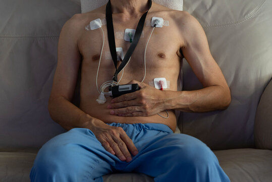 debt defaulting crisis concept. Male patient wearing a portable heart monitor with electrodes attached to the chest. Holter device is used for health diagnostics and monitoring cardiac activity.
