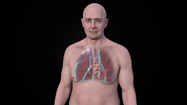 Man with apical tuberculosis, animation