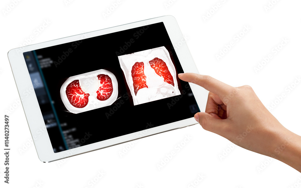 Aufkleber hand touching tablet display of ct chest scan shown on a tablet screen, with a hand pointing to the 
