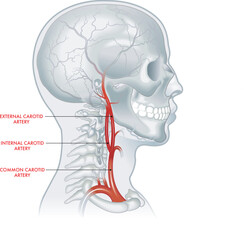 Medical illustration of carotid artery, with annotations