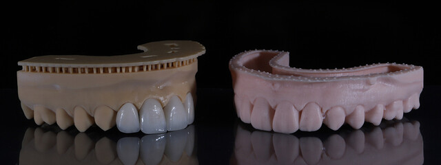 Dental aesthetics in dentistry with digital smile design treatment. Computer assisted jaw and mouth model with glass-ceramic porcelain laminate veneers. E-Max leaf porcelain dental crowns.  © UniqDream