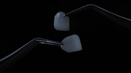 E-Max laminate veneers held with a plier called Presel used in dental dentistry. Dental veneers porcelain dental crowns.  © UniqDream