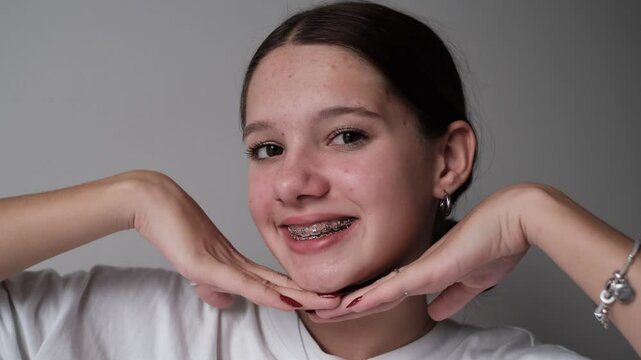 Love the bracket system, white background. Teenage girl love orthodontic treatment. Enjoy the straight teeth. Caucasian woman smiling with braces. 