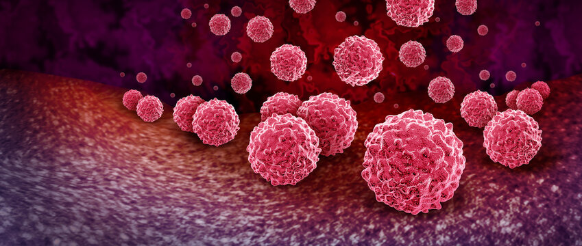 Chlamydia as a sexually transmitted infection or STD caused by the bacterium Chlamydia trachomatis bacterial infection often asymptomatic causing reproductive or health complications if untreated.