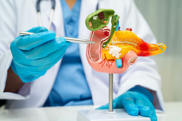 Pancreatitis, pancreatic cancer, Asian doctor with pancreas, gallbladder and bile duct human anatomy model at hospital.