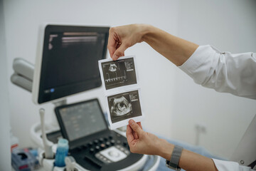 Doctor is holding results of ultrasonic test in hands