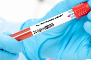 LH (Luteinizing Hormone) Test