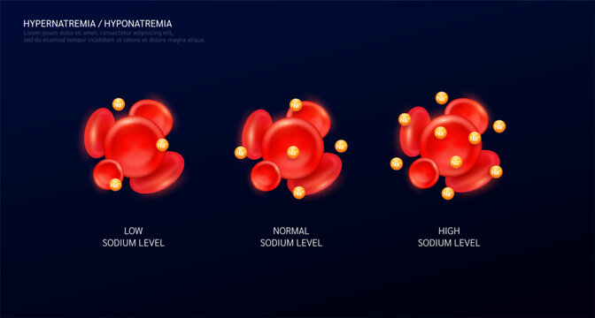 Hypernatremia is an electrolyte disorder. Sodium in red blood cells on black background. Balance level of minerals and vitamins in the body. Medical science concept. Vector EPS10.