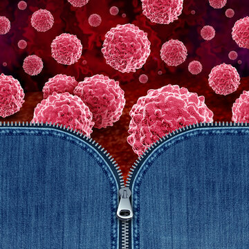 Chlamydia Sexually Transmitted Infection as an open Zipper on jeans concept or STD caused by the bacterium Chlamydia trachomatis bacterial infection.