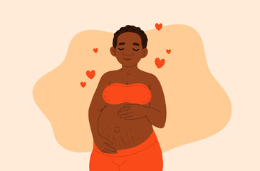 Pregnancy. Pregnant african black skin woman touching her belly with birthmark streches. Motherhood. Happy Mother's Day. Pretty women with tummy. Hand drawn flat cartoon vector illustration