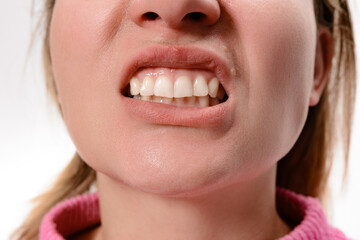 Close-up of a woman's mouth, with teeth clenched. Focus on the mouth area, highlighting the strain...