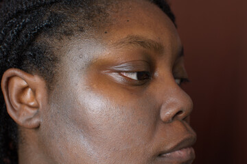 Sunscreen applied on brown skin, sunscreen leaving a white cast on dark brown skin, sun protection product on brown skin