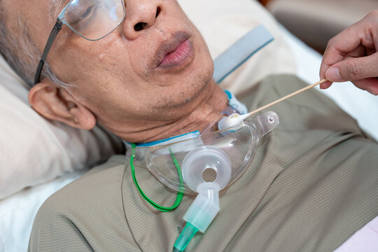 Patients who have undergone a tracheostomy for intubation