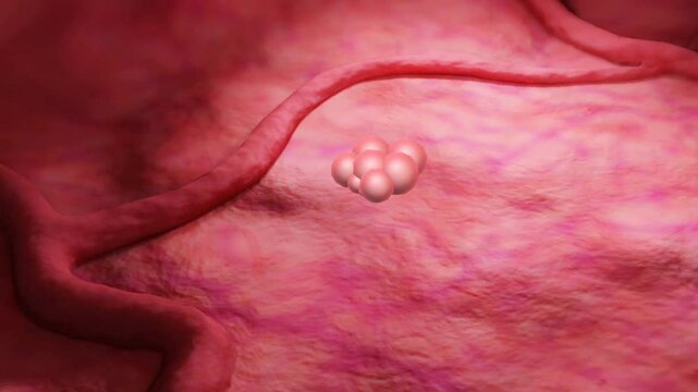 Lung cancer and metastasis