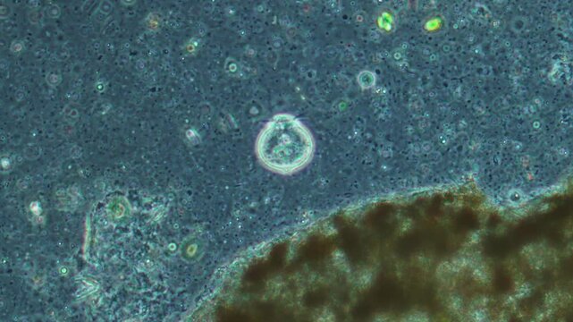 A large rotifer filters liquid by moving its oral villi, consuming bacteria. The rotifer hides its hairs in response to its environment.