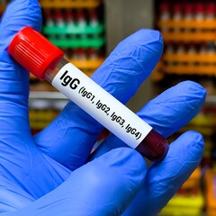 Blood sample tube for Immunoglobulin G or IgG (1,2,3,4) level test, diagnosis for immunodeficiency...