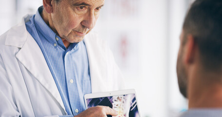 Doctor, patient or tablet with x ray in hospital for bone tumor, infection or spine fracture...