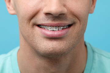 Obraz premium Smiling man with dental braces on light blue background, closeup