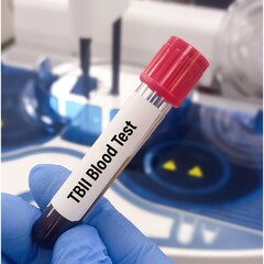 Blood sample for Thyrotropin binding inhibitory immunoglobulin (TBII) test, Thyrotropin receptor antibody test, to diagnosis of hyperthyroidism and Graves' disease.