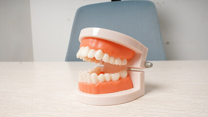 dental model on the table with open position