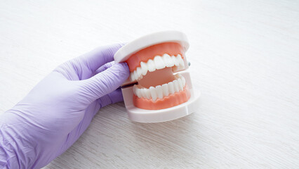 dental model held using purple medical gloves