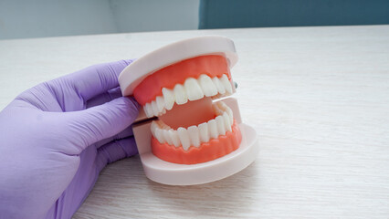 dental model held using purple medical gloves
