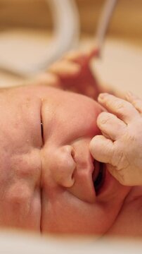Crying newborn baby on the table. Medic in latex gloves attaches the wire to a child's hand. Close up. Vertical video