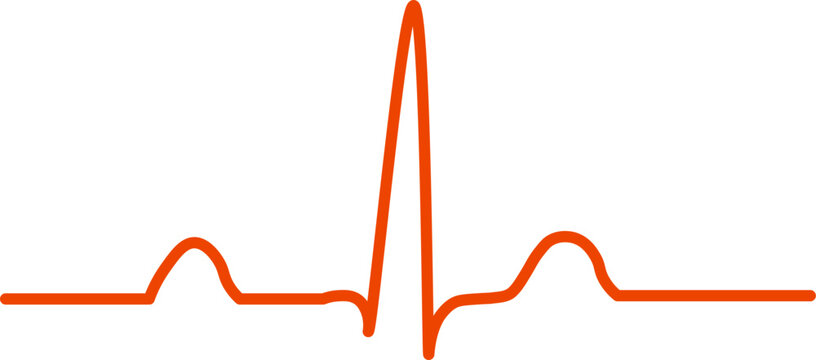 Normal Sinus Rhythm